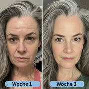 VoluFine - Korean Collagen Serum with Volufiline