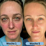 VoluFine - Korean Collagen Serum with Volufiline
