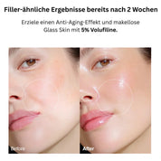 VoluFine - Korean Collagen Serum with Volufiline