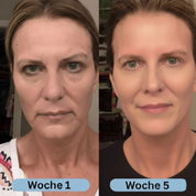 VoluFine - Korean Collagen Serum with Volufiline