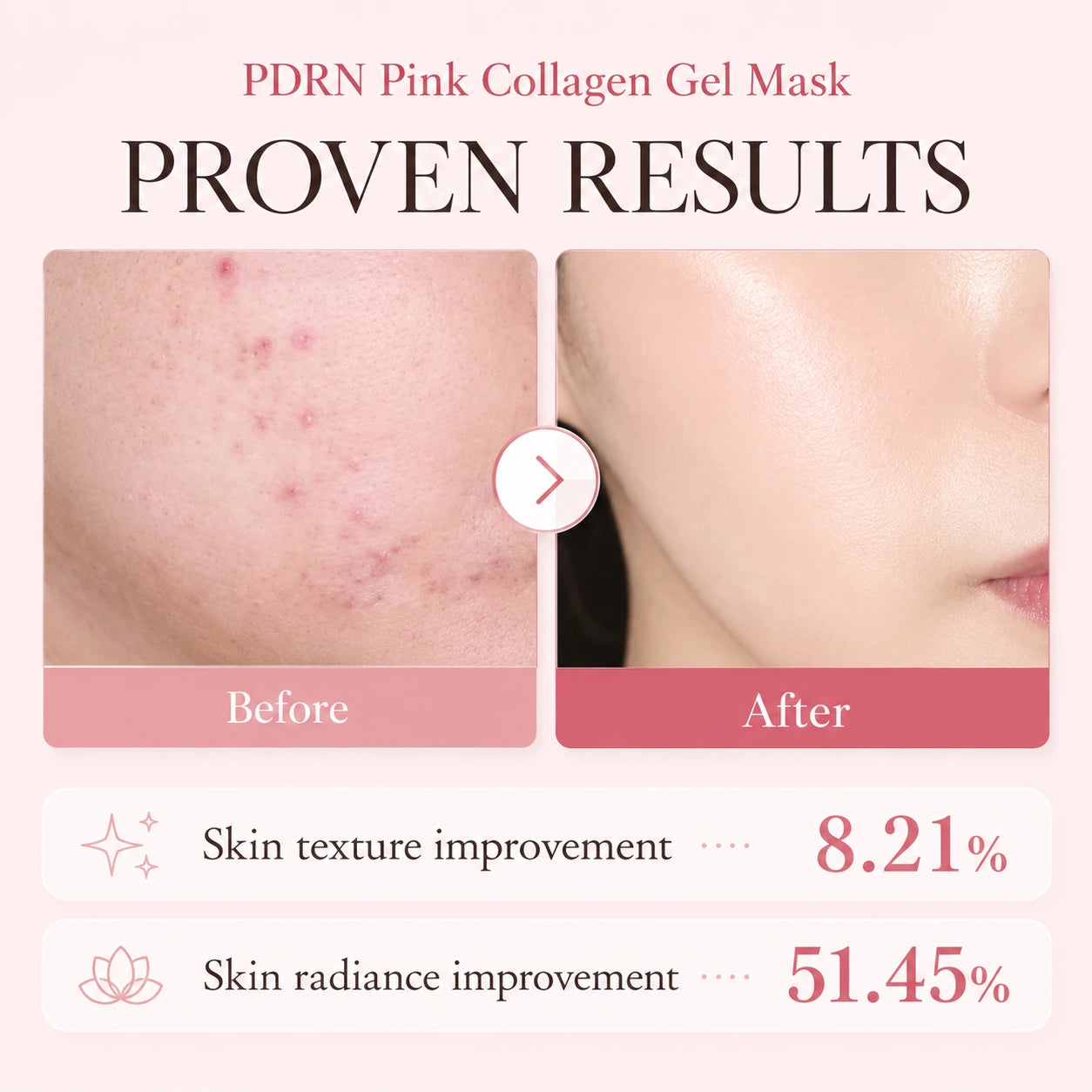 Maison Salmon PDRN Pink Collagen Jelly Gel Mask